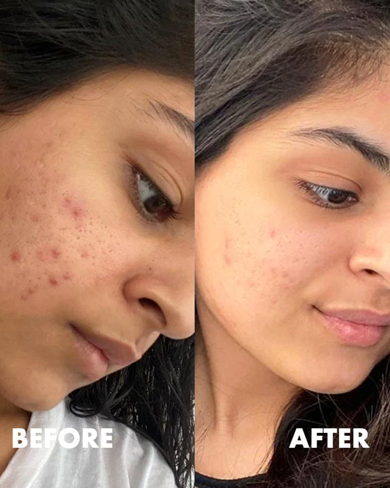 Moroccan Beauty Vitamin E Serum Multi-actions Acné, Cernes et Rides - 30ml