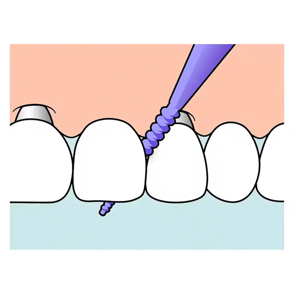 TePe EasyPick 36 Pièces Taille XL - Violet