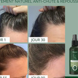 Moroccan Beauty Natural Anti-Hair Loss & Regrowth Lotion – Baicapil 3% + Rosemary – 100ml