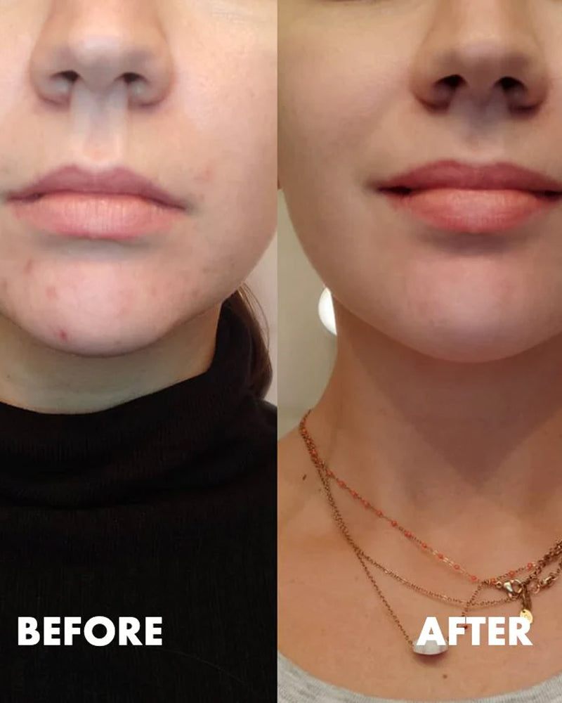 Moroccan Beauty Vitamin E Serum Multi-actions Acné, Cernes et Rides - 30ml