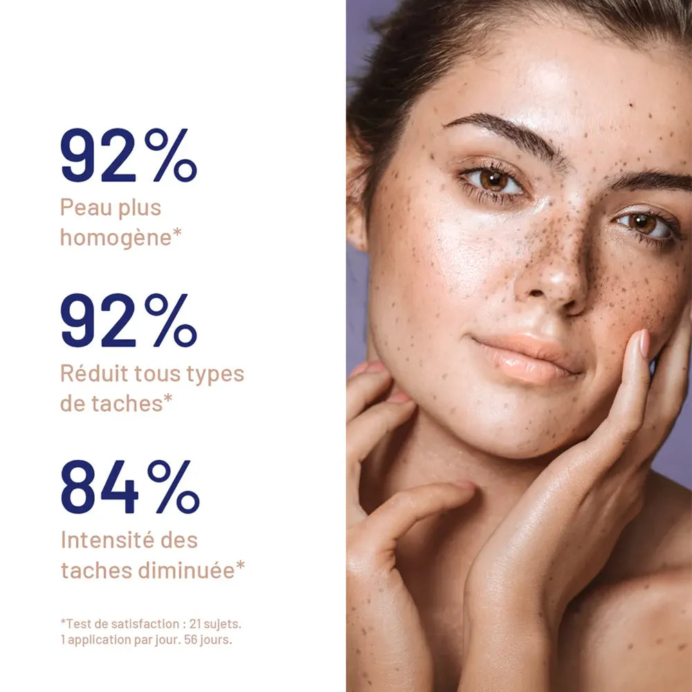 Soskin Meladerm Radiance Anti-Dark Spot Serum 30ml