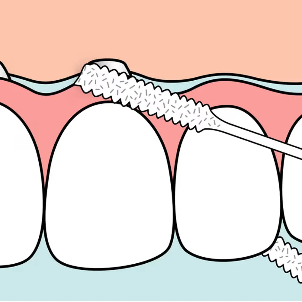 TePe Fil dentaire Bridge & Implant 30 Pièces