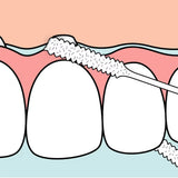 TePe Fil dentaire Bridge & Implant 30 Pièces